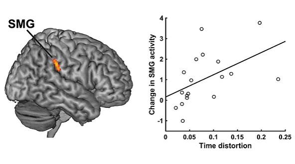 ტვინის აქტივობა SMG-ში, რომელიც მკვლევარების აზრით დროის სუბიექტური აღქმის ნეირონული კერაა.
